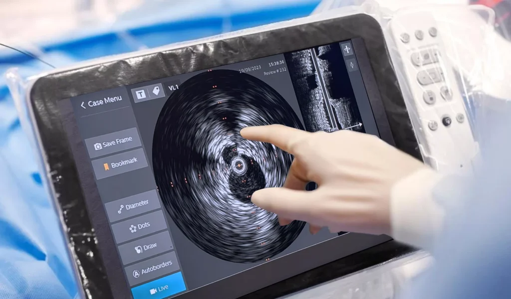 ef3d62d22f8149bcbd57b0df00aebbb8